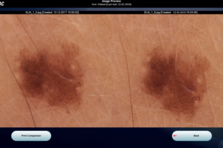 gcmp-skindoc-1